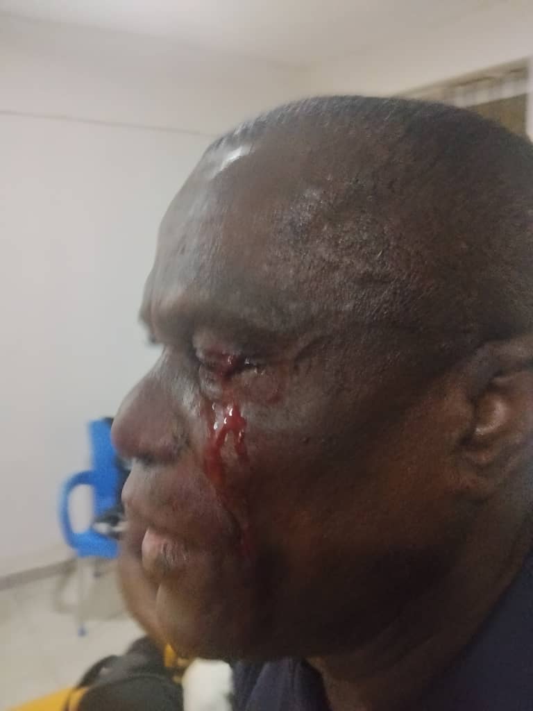 DRAW TURNS DRAMA: NPFL Chief Attacked In Post-Match Chaos                                        //Kunle Oyeleye